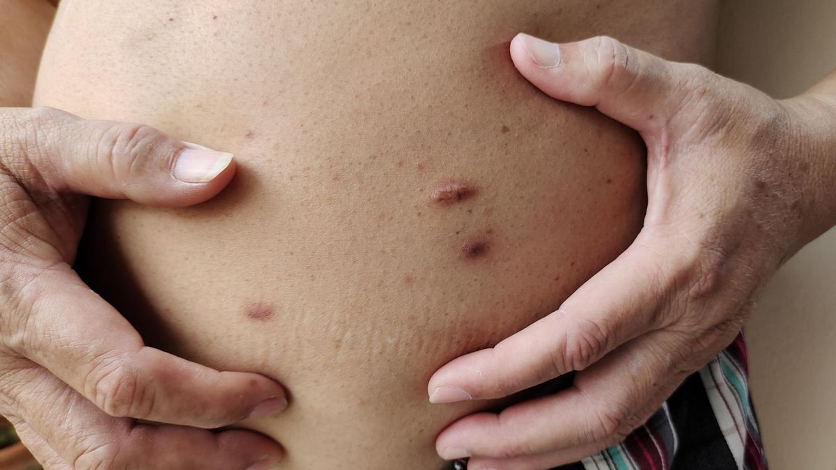 Trzustka woła o pomoc. Zauważysz w ciągu 48 godzin