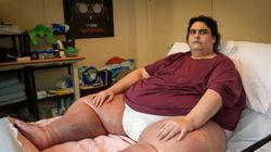 "Najgrubszy Brytyjczyk" boi się, że umrze. "To bomba zegarowa"