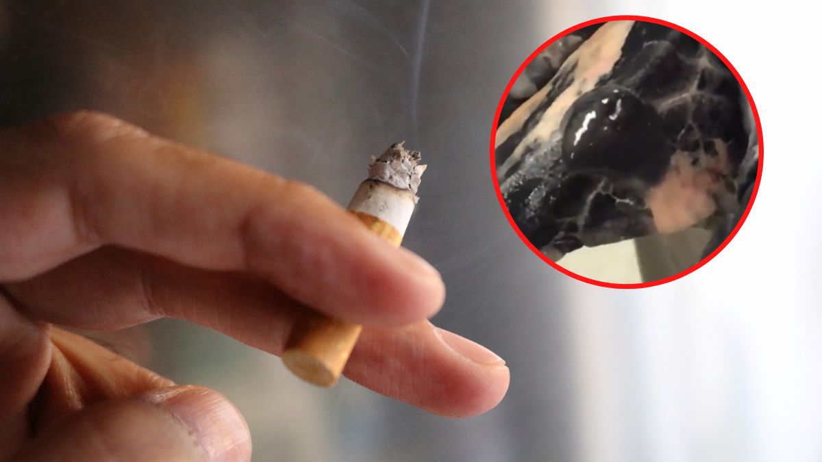 Płuca czarne niczym smoła to skutek palenia papierosów