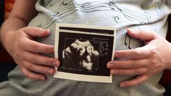 AI pomogła zajść w ciążę po 18 latach niepłodności. Przełomowy przypadek