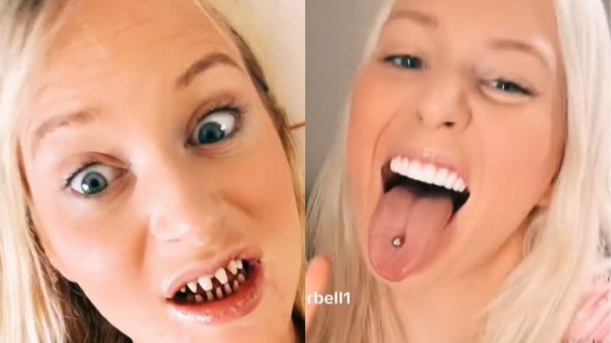 Zrobiła "tureckie zęby". Uwielbia swój nowy uśmiech. 