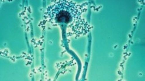 Grzyby coraz odporniejsze na leki przeciwgrzybicze 1