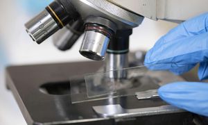 Odkryto najmniejsze bateryjne genomy. Dokonanie polskich naukowców