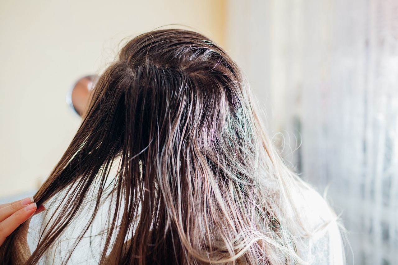 Hausmittel gegen fettiges Haar: Effektive Tipps für den Alltag