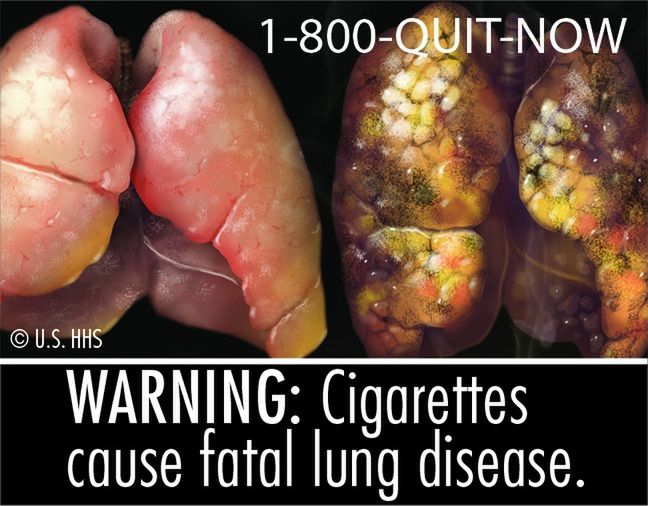 UWAGA: Papierosy są przyczyną śmiretelnych chorób płuc.