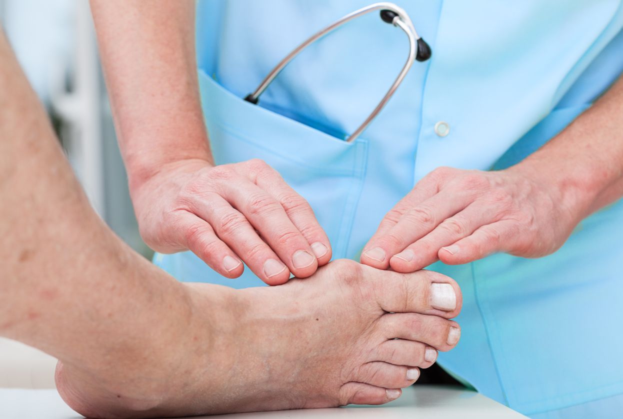 Ćwiczenia na haluksy – jakie i po co warto wykonywać?