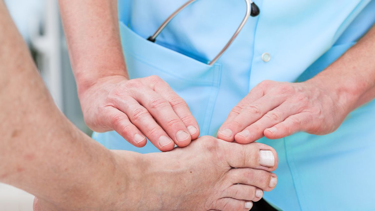 Ćwiczenia na haluksy mogą okazać się niezwykle pomocne.