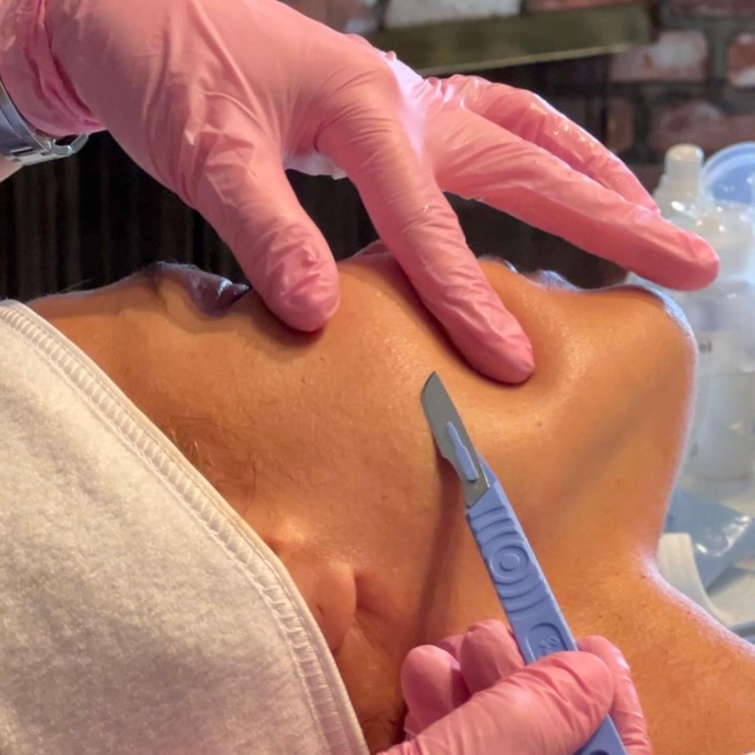 Eva Mendes podczas zabiegu dermaplaningu