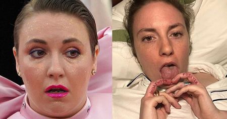 Lena Dunham wyznała, że cierpi na NIEULECZALNĄ CHOROBĘ: "Potrzebuję wsparcia"