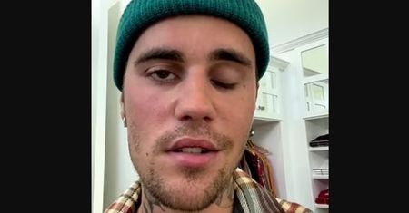 Justin Bieber ma sparaliżowaną twarz. Jest diagnoza lekarzy