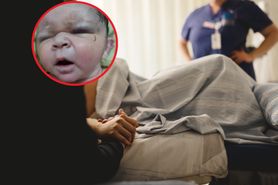 Dziecko miało urodzić się martwe. Zaskoczeni lekarze chwycili za kamerę