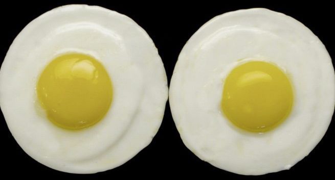 „Ceń swoje życie” - Lifetime zachęca kobiety do regularnych badań piersi