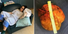 Mąż myślał, że jest opętana. Miała zapalenie mózgu 