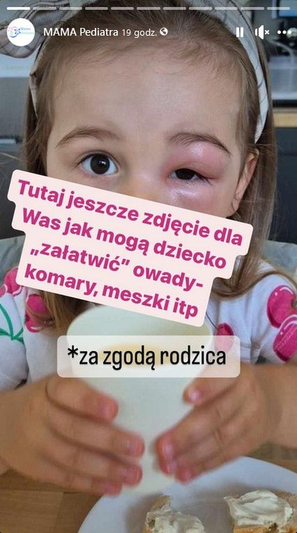 Efekt ukłucia komara