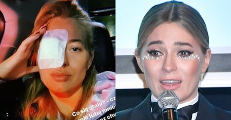 Marcelina Zawadzka musiała WYŁYŻECZKOWAĆ zmianę na powiece po nieudanym zabiegu doklejania rzęs (FOTO)