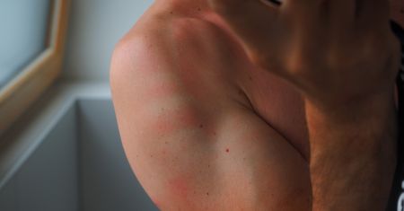 Panthenol Spray - skład, działanie, wskazania, przeciwwskazania, sposób aplikacji