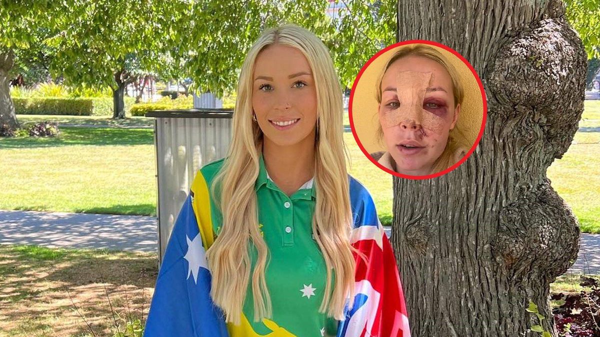 Taylah McCutheon pokazała zdjęcie po wypadku