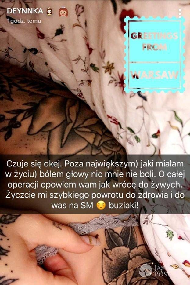 Deynn relacjonuje samopoczucie po operacji plastycznej