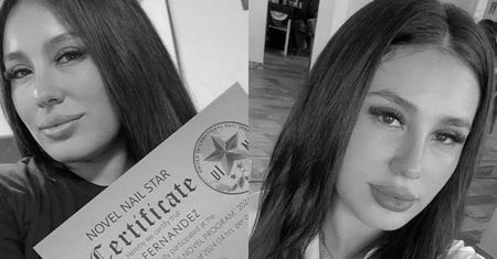 Poddała się operacji plastycznej. Zmarła 30-letnia influencerka