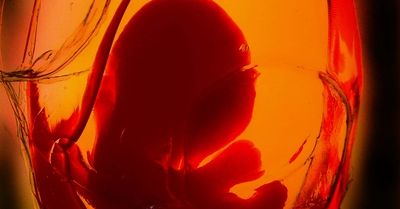 Polskie podziemie aborcyjne