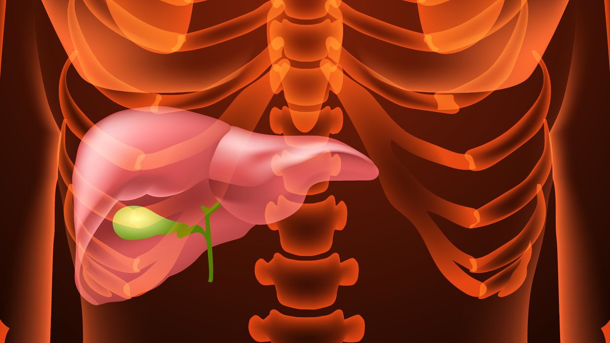 Istnieją naturalne kuracje na usunięciu pisaku z pęcherzyka żółciowego.