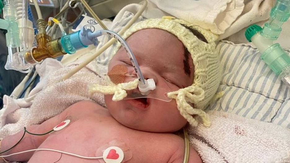 Poród jak z horroru. "Lekarz ciągnął, nawet jak nie było skurczów"