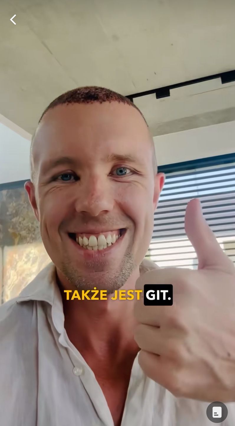 Dawid Piątkowski relacjonuje przeszczep włosów