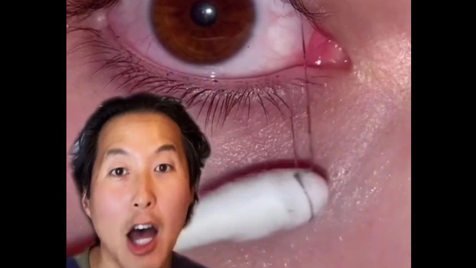 Używasz tuszu do rzęs? Lekarz ostrzega