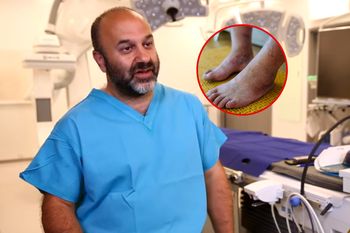 Nie lekceważ objawu. Zapach ostrzega, że cholesterol jest wysoki