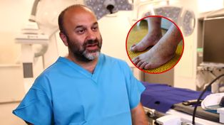 Nie lekceważ objawu. Zapach ostrzega, że cholesterol jest wysoki