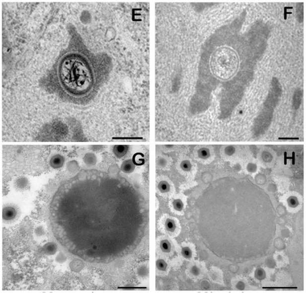 Na zdjęciach E i G Megavirus chilensis (Fot. Popular Science)