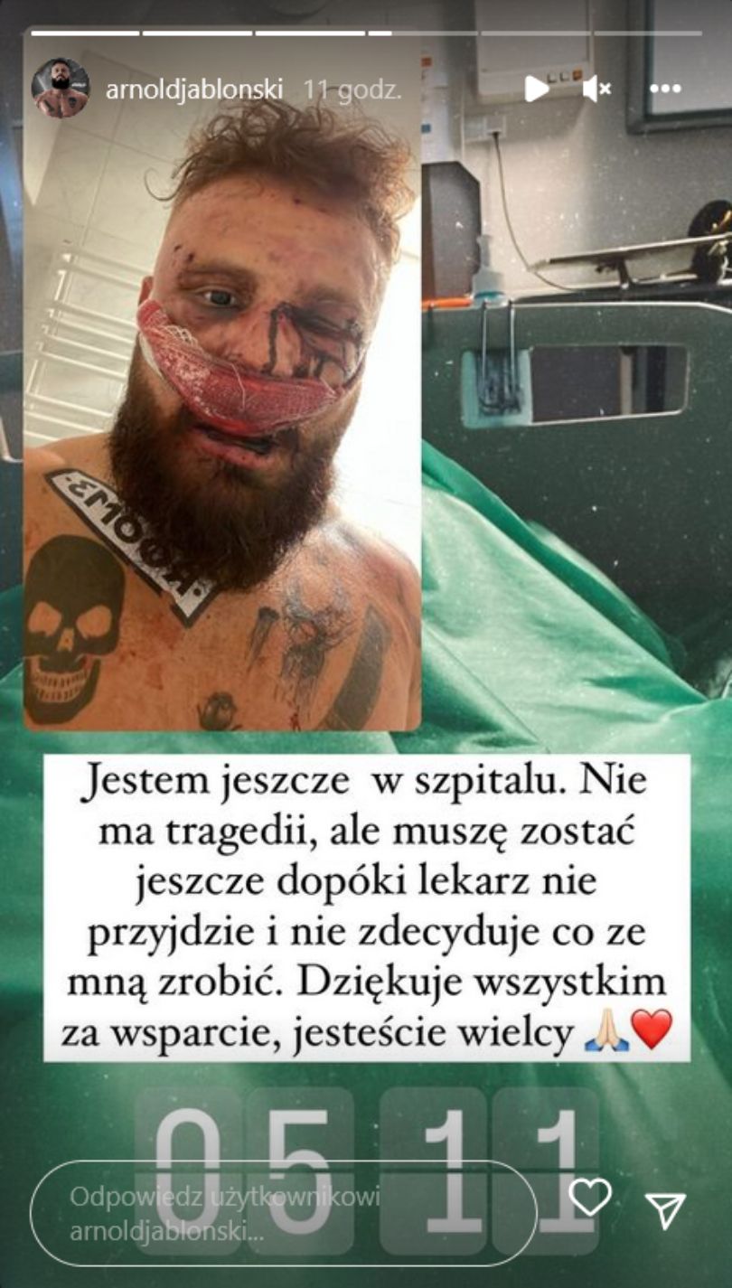 Arnold Jabłoński prezentuje poobijaną twarz po walce z Kubą Wójcikiem