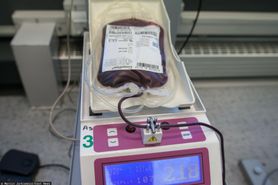 Grupa krwi może wpływać na przebieg COVID-19? Nowe badania
