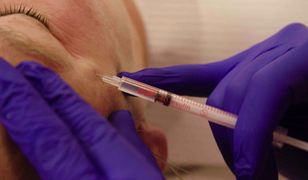 "Daj się odmienić". Kolejna spektakularna metamorfoza. Takiej zmiany nie spodziewał się nikt