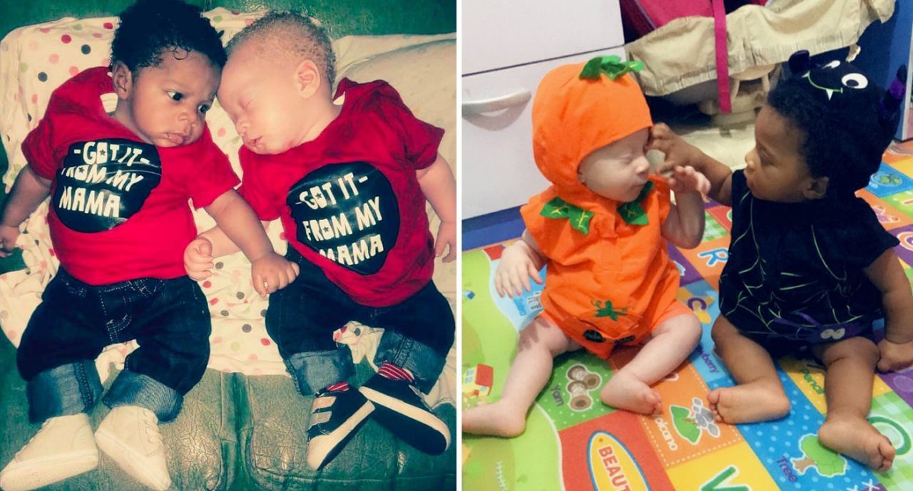 Bliźniaki o różnym kolorze skóry