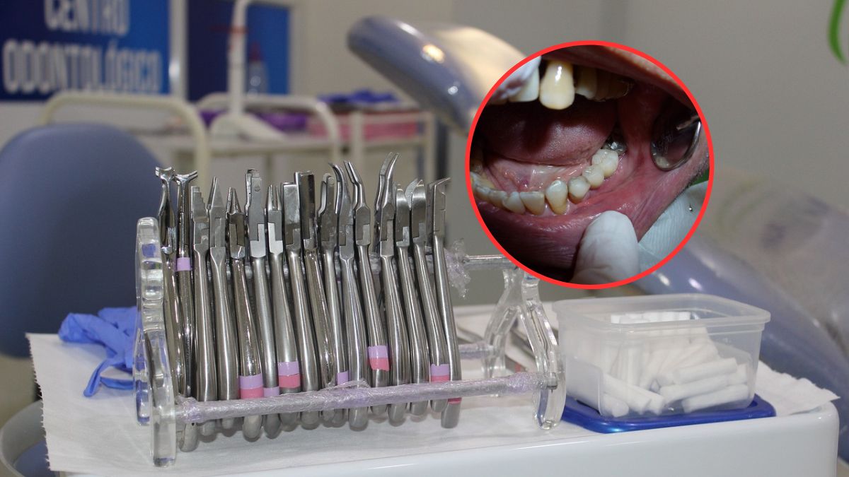 Od 2025 r. UE zakazuje plomb amalgamatowych