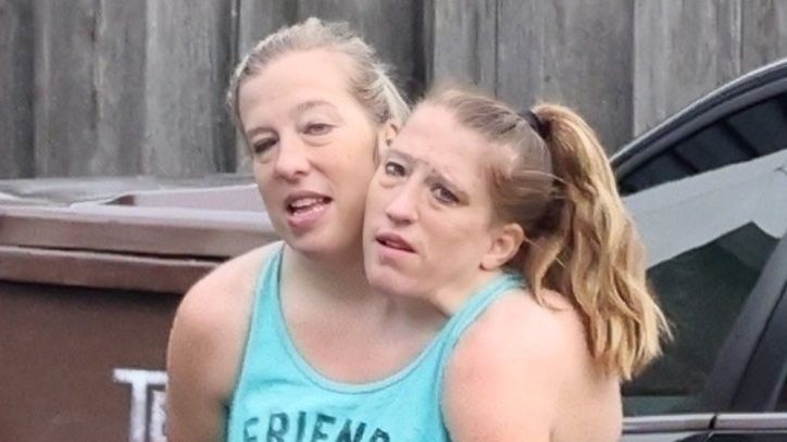 Abby i Brittany Hensel 