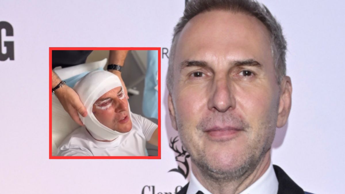 Dr Krzysztof Gojdź przeszedł kosztowny zabieg twarzy