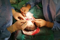 Śląskie. Maszyna oskalpowała kobietę przy pracy. Lekarze z Gliwic dokonali cudu