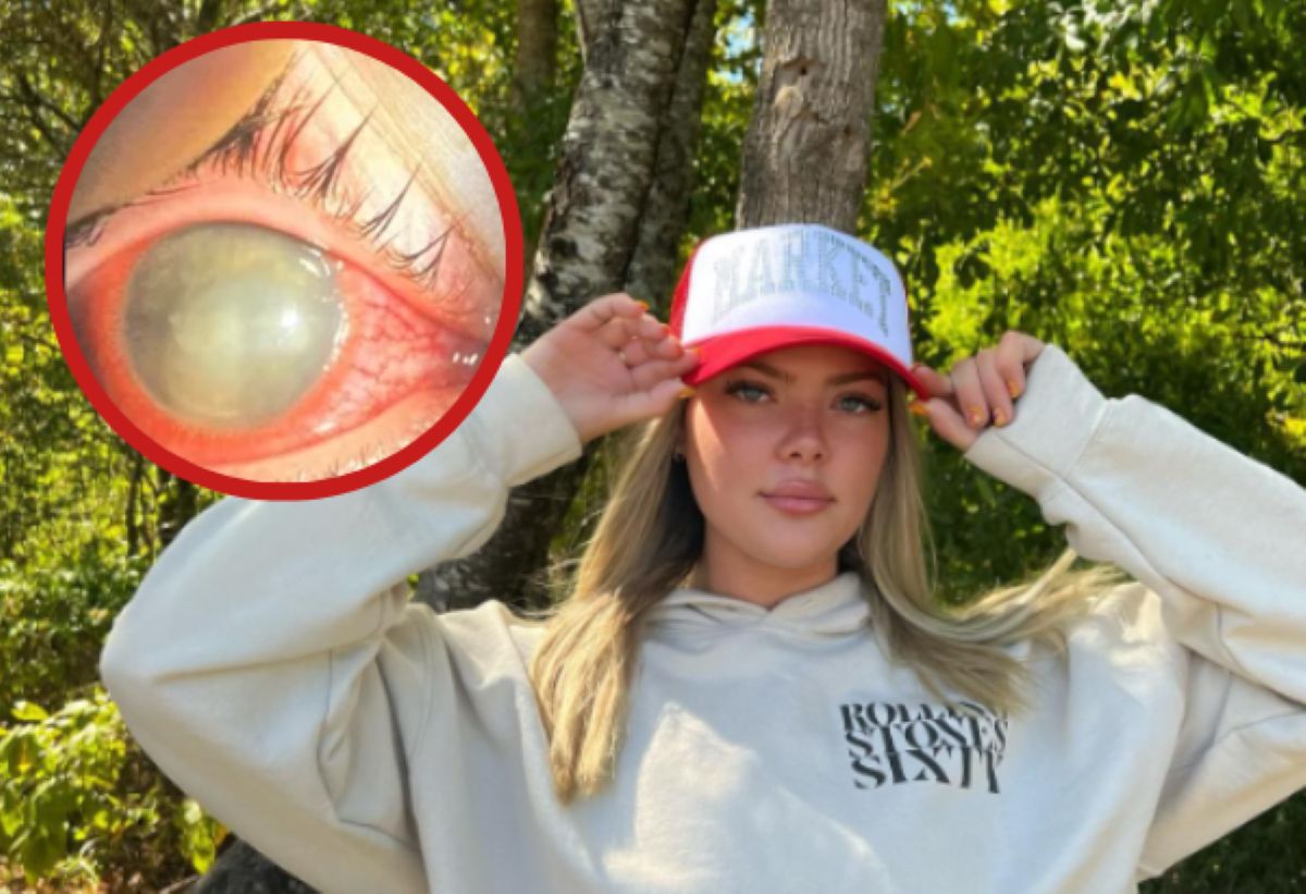 Brooklyn Mccasland straciła wzrok w prawym oku