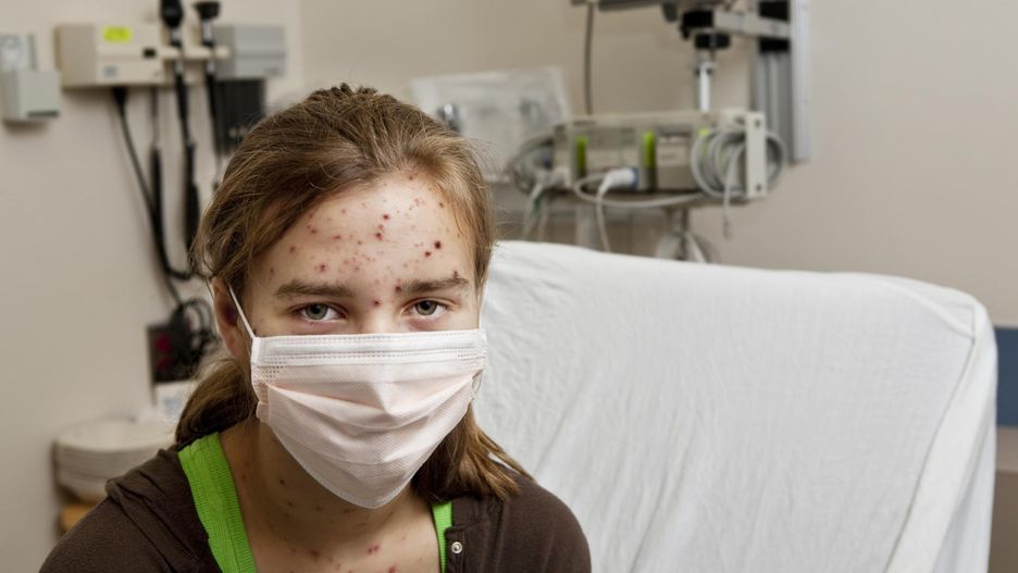 Szczepienie przeciw ospie może uchronić przed poważnymi komplikacjami