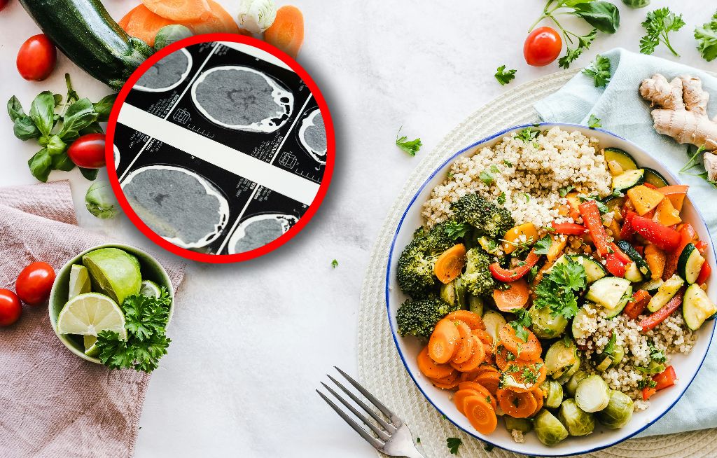 Tą dietą możesz obniżyć ryzyko choroby Alzheimera. Nowe badania