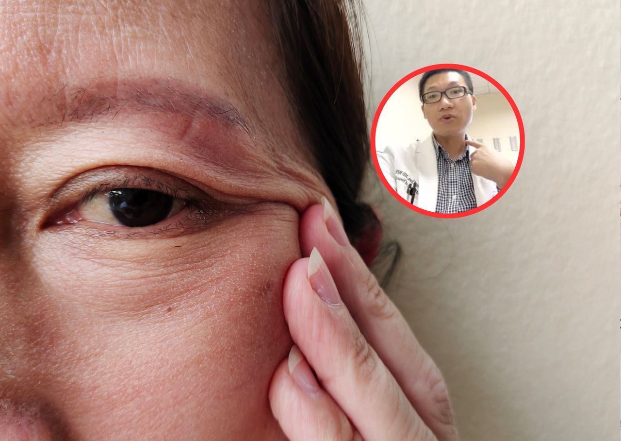 Pojawia się przy tętniakach mózgu. "To może być ostrzeżenie"