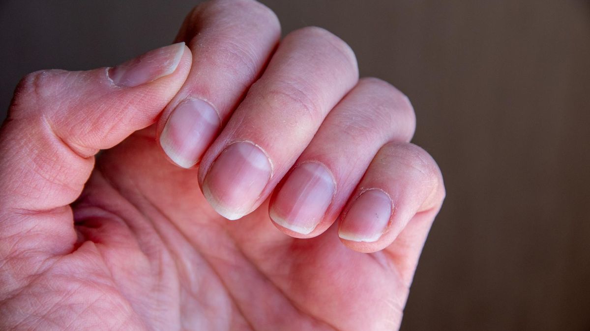 Zimne, przesuszone dłonie mogą świadczyć m.in. o problemach z tarczycą