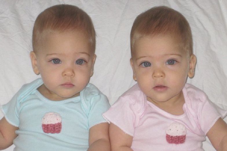 Uznano je za najpiękniejsze bliźniaczki na świecie. Jak dziś wyglądają?