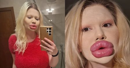 Zapragnęła mieć NAJWIĘKSZE USTA NA ŚWIECIE. "Bułgarska Barbie" przeszła szokującą metamorfozę. Nie uwierzycie, jak wyglądała wcześniej