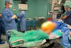 Lekarze ze Świdnicy usunęli gigantyczny guz jajnika. Ważył 20 kilogramów