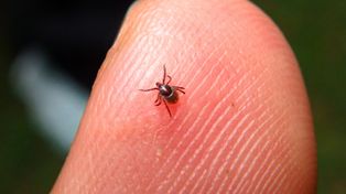Coraz więcej zachorowań na boreliozę w woj. śląskim! W tych miejscach w regionie jest najwięcej kleszczy. Zobacz mapę – tutaj trzeba uważać