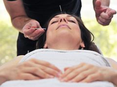 Akupunktura kosmetyczna alternatywą dla botoksu
