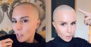 Blanka Lipińska opisuje moment, gdy pierwszy raz zobaczyła swoją łysą głowę: "To było jak ZDERZENIE Z POCIĄGIEM"